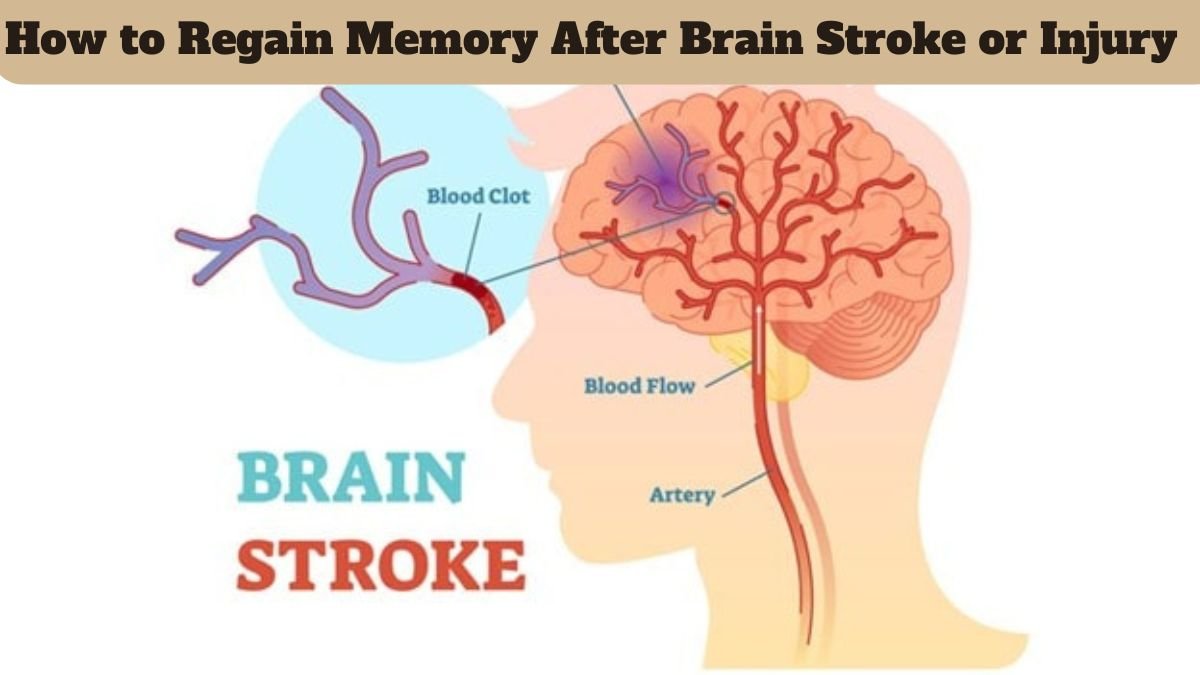 How to Regain Memory After Brain Stroke or Injury